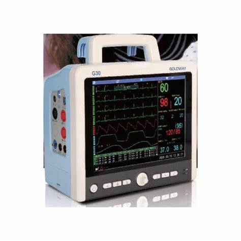 Philips Para Monitor G30 E portable patient monitor displaying vital signs and ECG waveforms