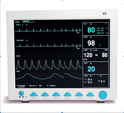 Contec 5 multi-parameter medical monitor displaying ECG, SpO2, NIBP, respiration, and temperature readings